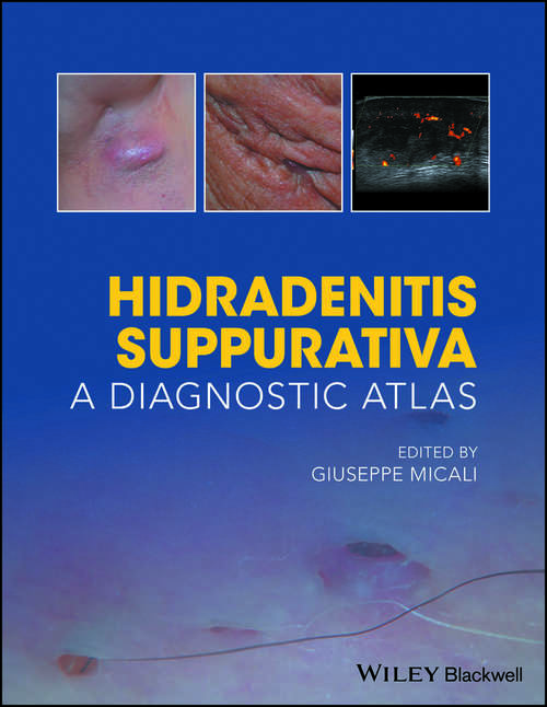 Book cover of Hidradenitis Suppurativa: A Diagnostic Atlas