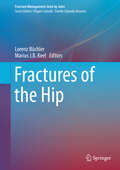 Fractures of the Hip (Fracture Management Joint by Joint)