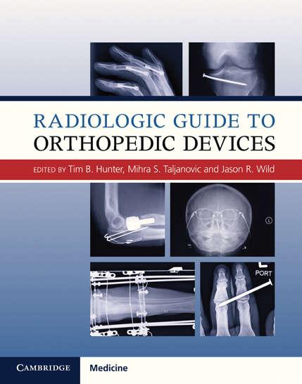 Radiologic Guide to Orthopedic Devices