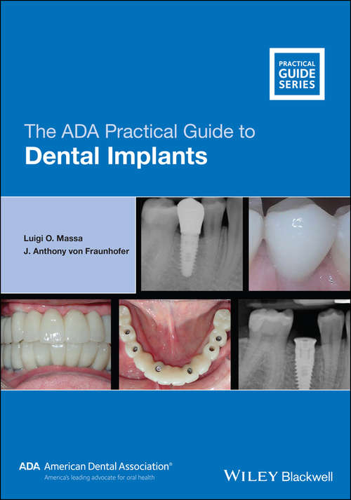 The ADA Practical Guide to Dental Implants (ADA Practical Guide)