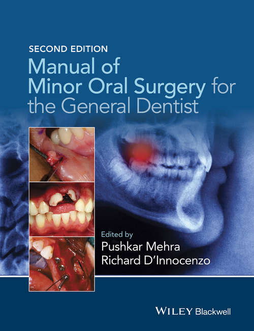 Book cover of Manual of Minor Oral Surgery for the General Dentist