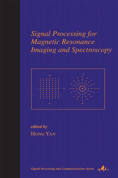 Book cover of Signal Processing for Magnetic Resonance Imaging and Spectroscopy (1)