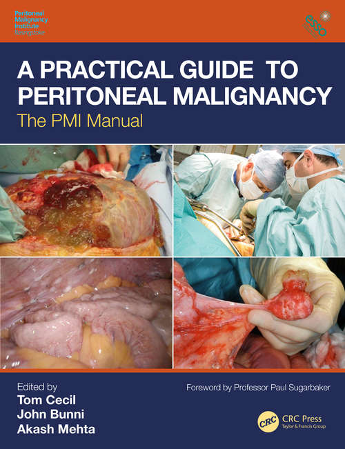Book cover of A Practical Guide to Peritoneal Malignancy: The PMI Manual