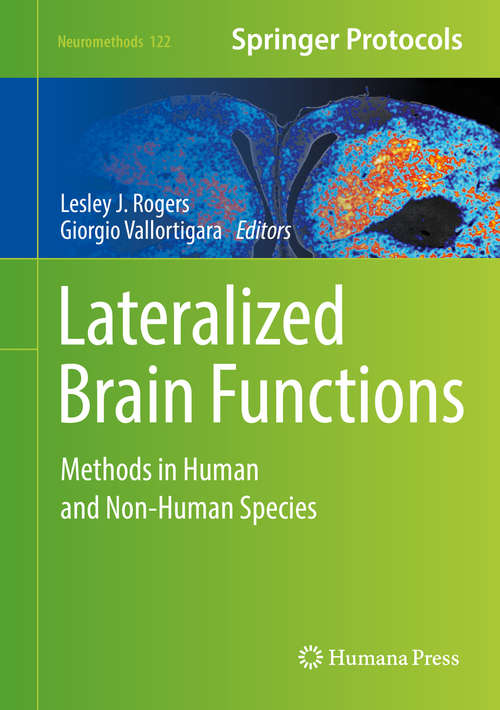 Lateralized Brain Functions