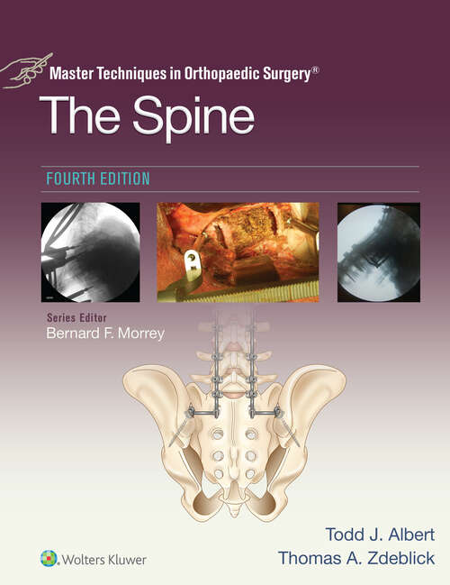 Book cover of Master Techniques in Orthopaedic Surgery: The Spine (Master Techniques in Orthopaedic Surgery)