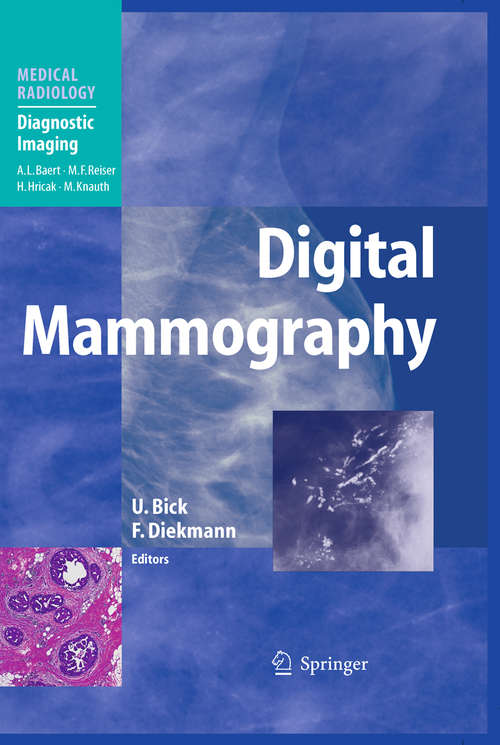 Book cover of Digital Mammography