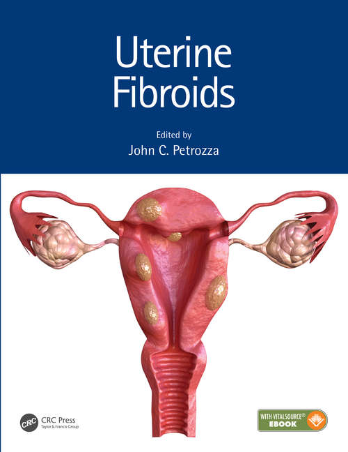 Book cover of Uterine Fibroids
