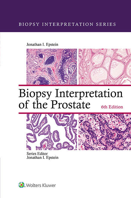 Book cover of Biopsy Interpretation of the Prostate (Biopsy Interpretation Series)