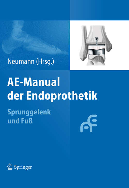 Book cover of AE-Manual der Endoprothetik