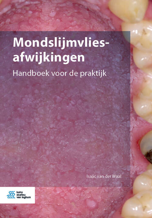 Book cover of Mondslijmvliesafwijkingen: Handboek voor de praktijk (1st ed. 2020)