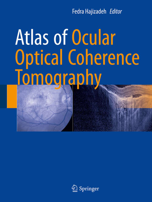 Book cover of Atlas of Ocular Optical Coherence Tomography