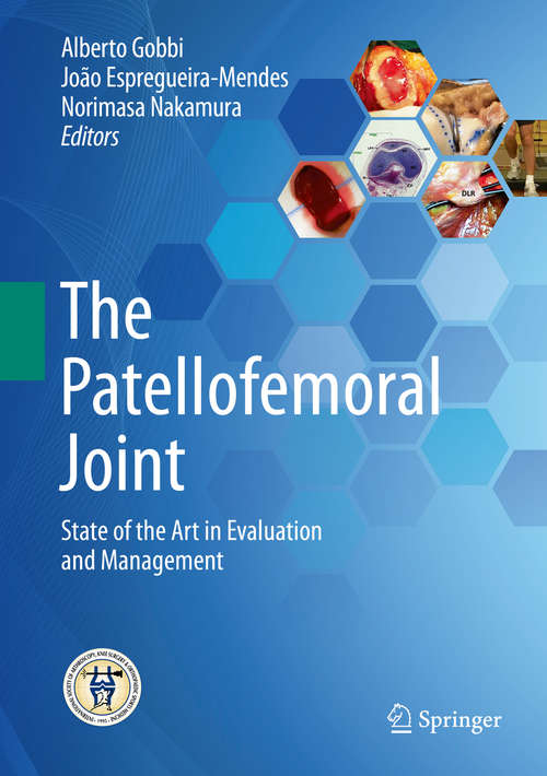 Cover image of The Patellofemoral Joint