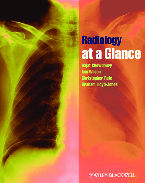 Radiology at a Glance (At A Glance Ser.)