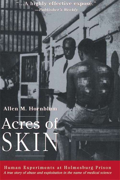 Book cover of Acres of Skin: Human Experiments at Holmesburg Prison