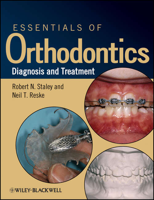Book cover of Essentials of Orthodontics: Diagnosis and Treatment