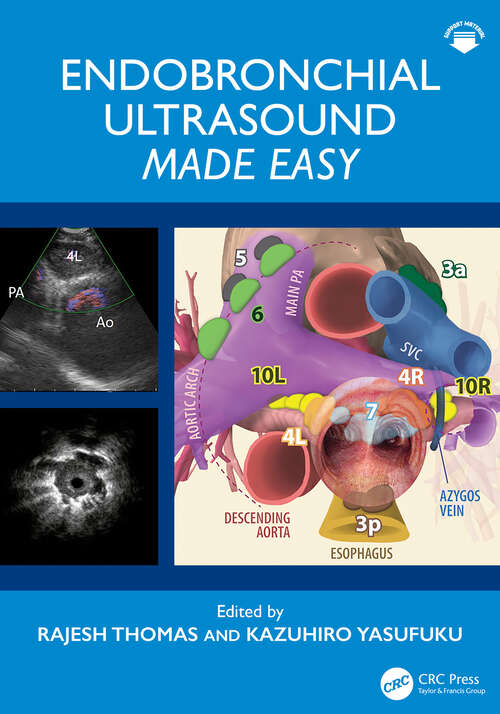Book cover of Endobronchial Ultrasound Made Easy (1)