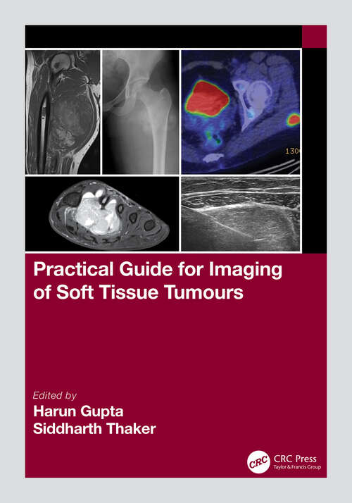 Book cover of Practical Guide for Imaging of Soft Tissue Tumours