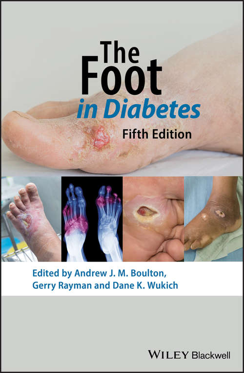 The Foot in Diabetes (Practical Diabetes)
