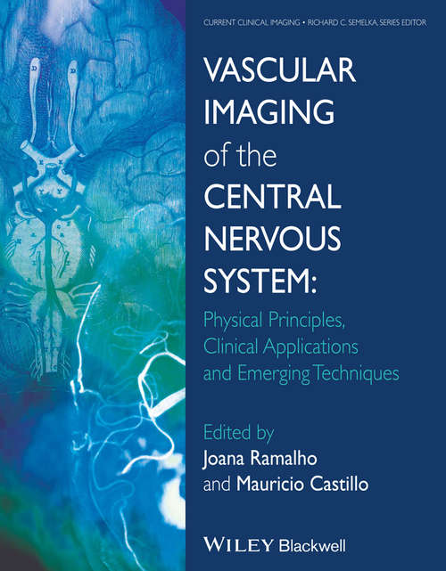 Book cover of Vascular Imaging of the Central Nervous System