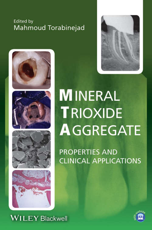 Book cover of Mineral Trioxide Aggregate