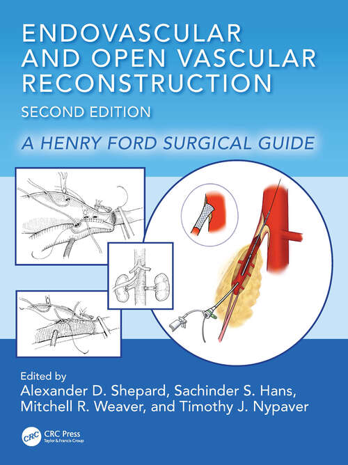 Book cover of Endovascular and Open Vascular Reconstruction: A Henry Ford Surgical Guide (2)