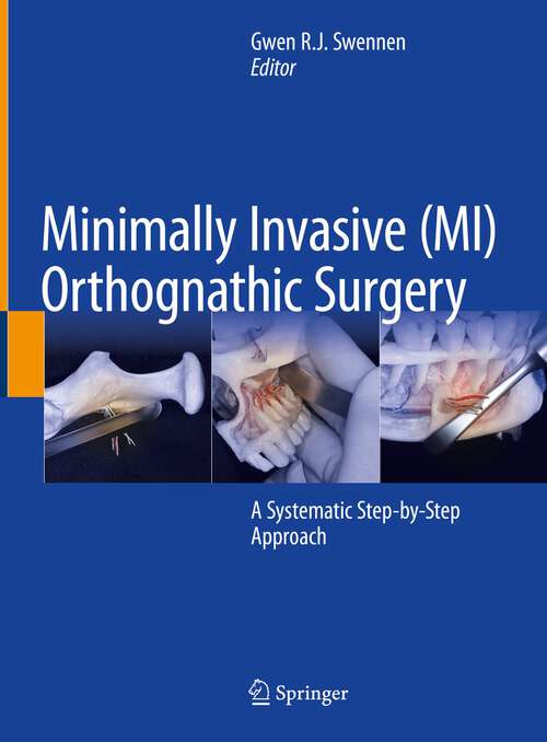 Book cover of Minimally Invasive (MI) Orthognathic Surgery: A Systematic Step-by-Step Approach (1st ed. 2023)