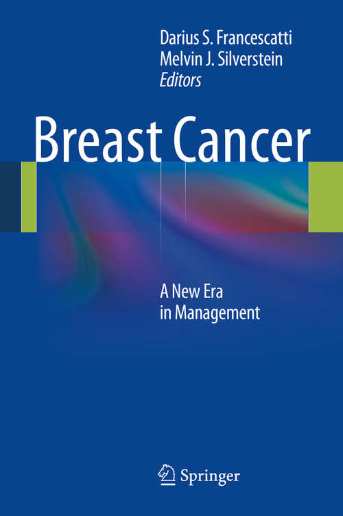 Book cover of Breast Cancer