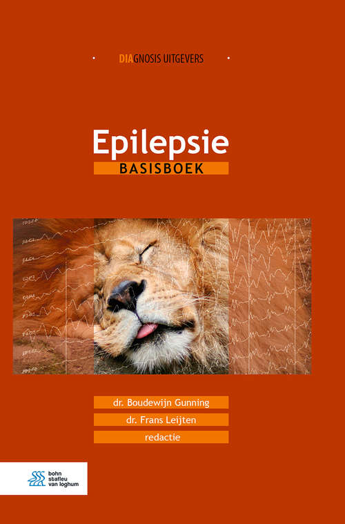 Book cover of Epilepsie