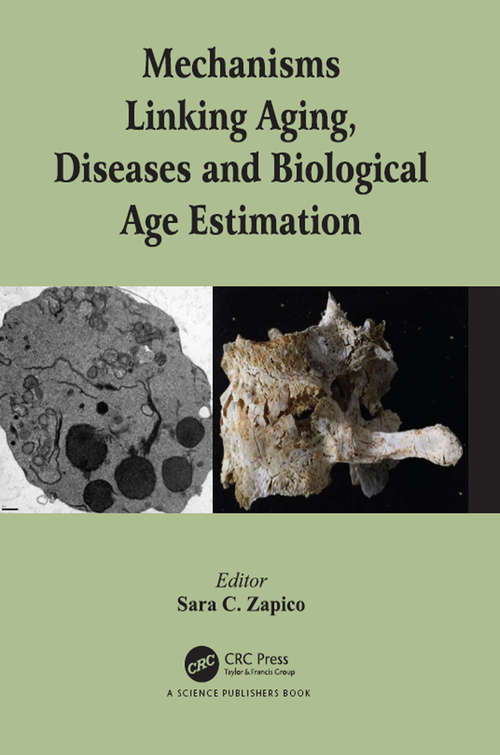Book cover of Mechanisms Linking Aging, Diseases and Biological Age Estimation