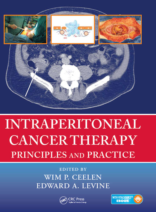 Book cover of Intraperitoneal Cancer Therapy: Principles and Practice