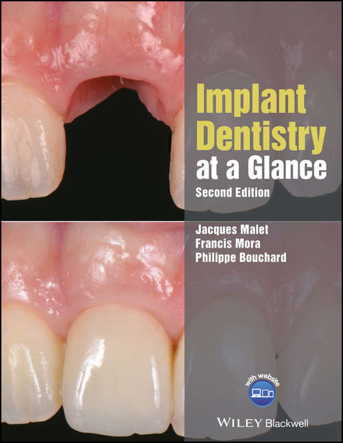 Implant Dentistry at a Glance (At a Glance (Dentistry) #60)