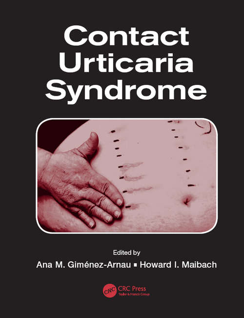 Contact Urticaria Syndrome: Diagnosis And Management (Updates in Clinical Dermatology)