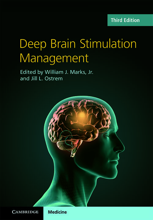 Book cover of Deep Brain Stimulation Management
