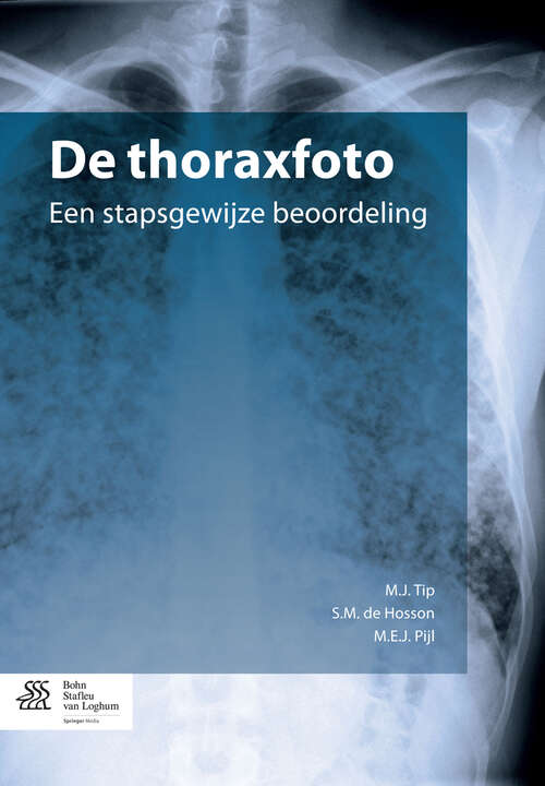 De thoraxfoto