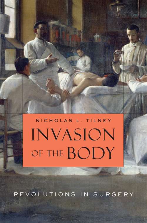 Book cover of Invasion of the Body: Revolutions in Surgery