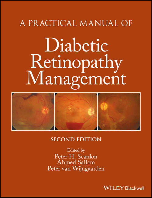Book cover of A Practical Manual of Diabetic Retinopathy Management
