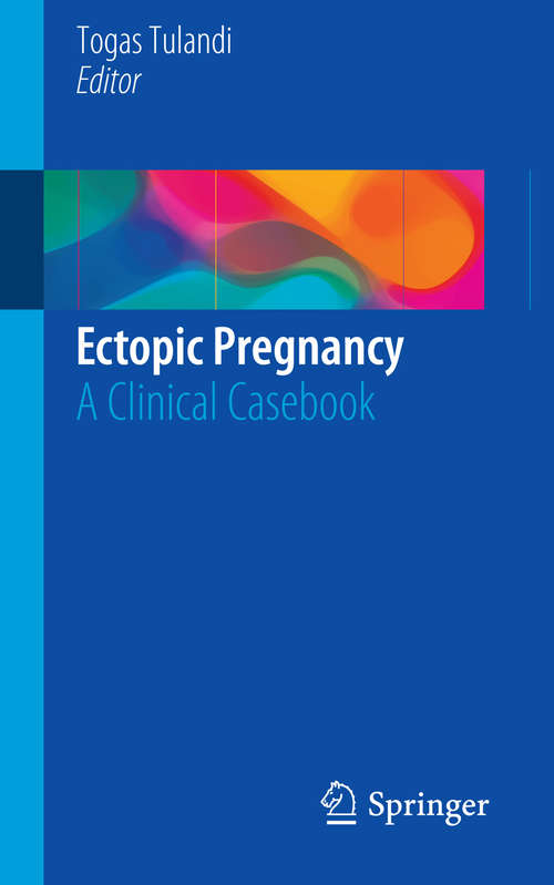 Book cover of Ectopic Pregnancy
