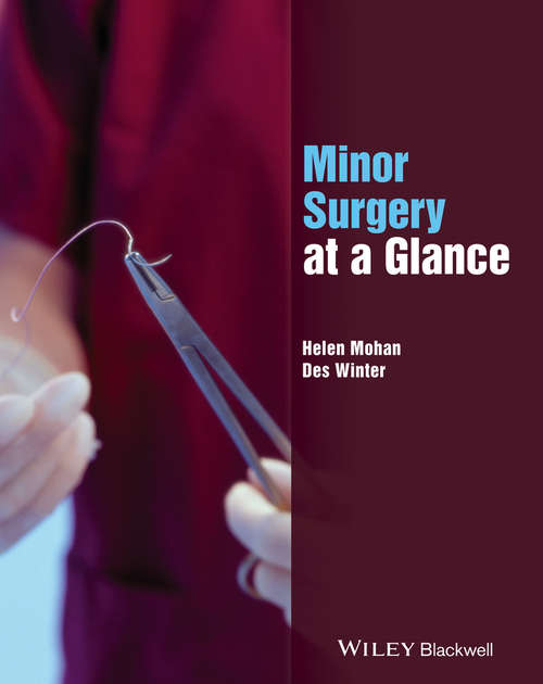 Book cover of Minor Surgery at a Glance