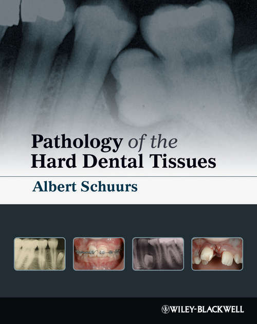 Book cover of Pathology of the Hard Dental Tissues