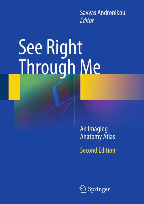 Book cover of See Right Through Me