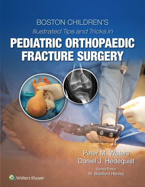 Boston Children’s Illustrated Tips and Tricks in Pediatric Orthopaedic Fracture Surgery