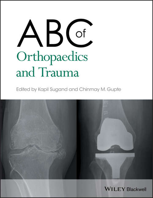 Book cover of ABC of Orthopaedics and Trauma (ABC Series)