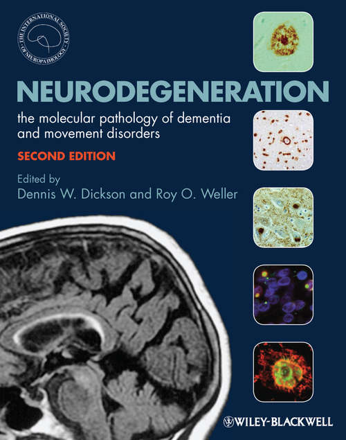 Neurodegeneration: The Molecular Pathology of Dementia and Movement Disorders (Second Edition)