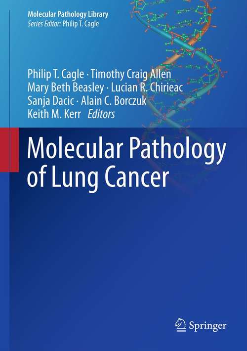 Book cover of Molecular Pathology of Lung Cancer