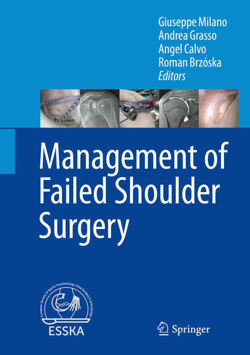 Book cover of Management of Failed Shoulder Surgery