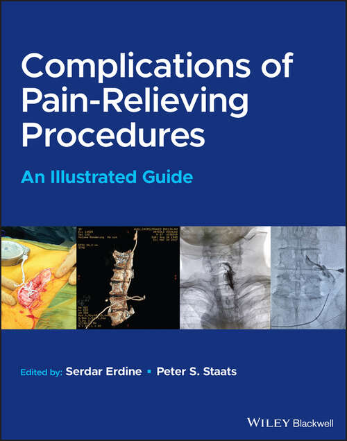 Book cover of Complications of Pain-Relieving Procedures: An Illustrated Guide