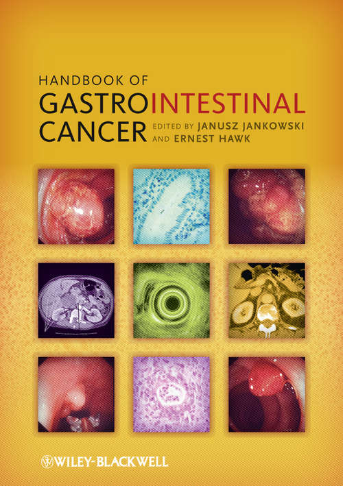 Book cover of Handbook of Gastrointestinal Cancer