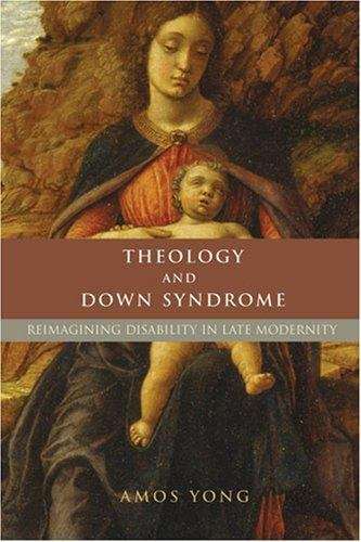 Theology And Down Syndrome: Reimagining Disability In Late Modernity