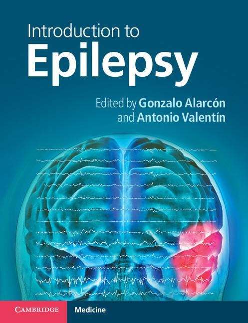 Book cover of Introduction to Epilepsy