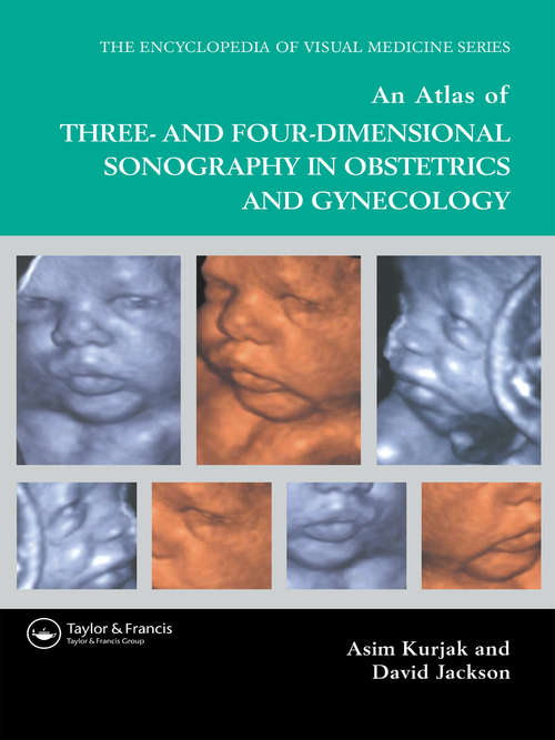 An Atlas of Three- and Four-Dimensional Sonography in Obstetrics and Gynecology